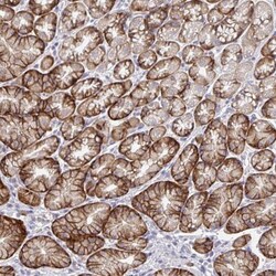 TMEM41A Antibody, Novus Biologicals 0.1mL; Unlabeled:Antibodies, Polyclonal